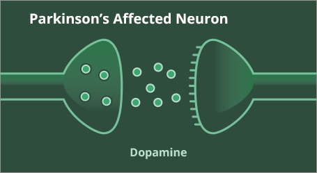 Dopamine levels in a Parkinson's affected neuron
